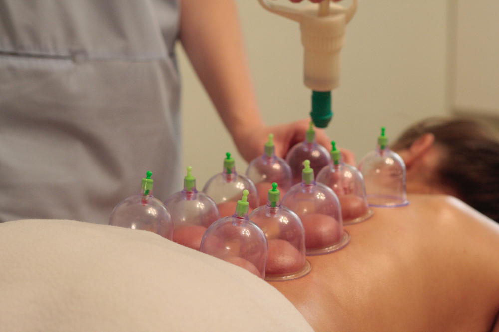 30 Minute Contemporary Cupping
