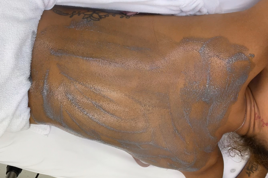 Back Facial