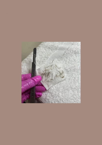 Dermaplaning ADD ON