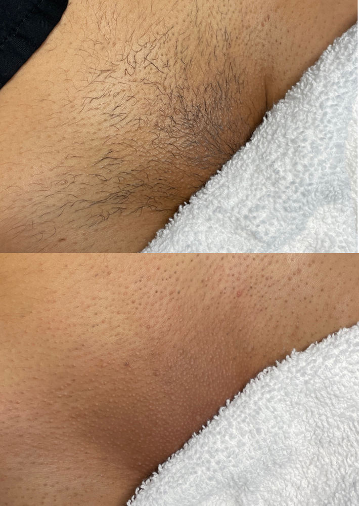 Brazilian Wax