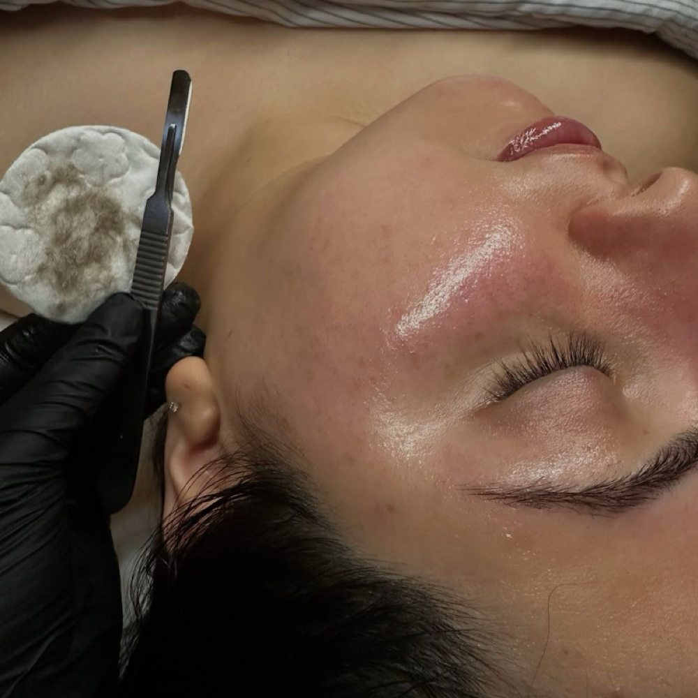 the express facial at 828aesthetics in Henderson, NV