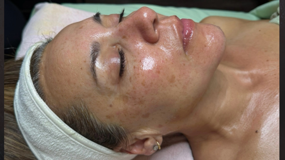 CUSTOM FACIAL
