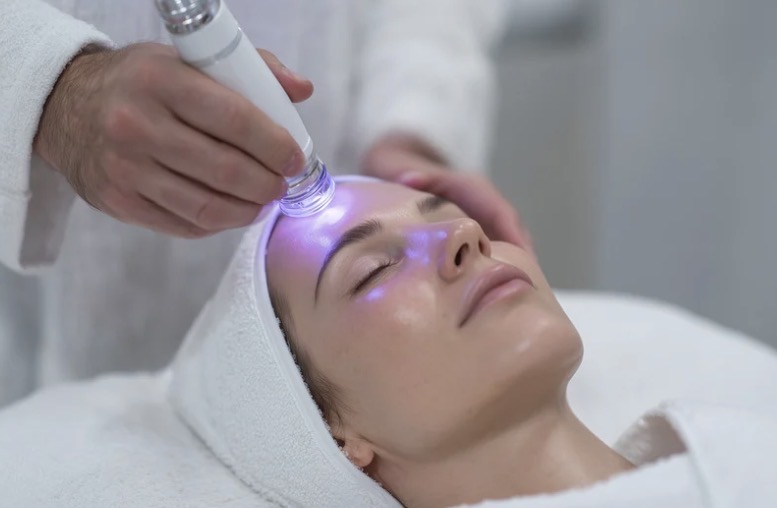 Facial Lift with Radiofrequency