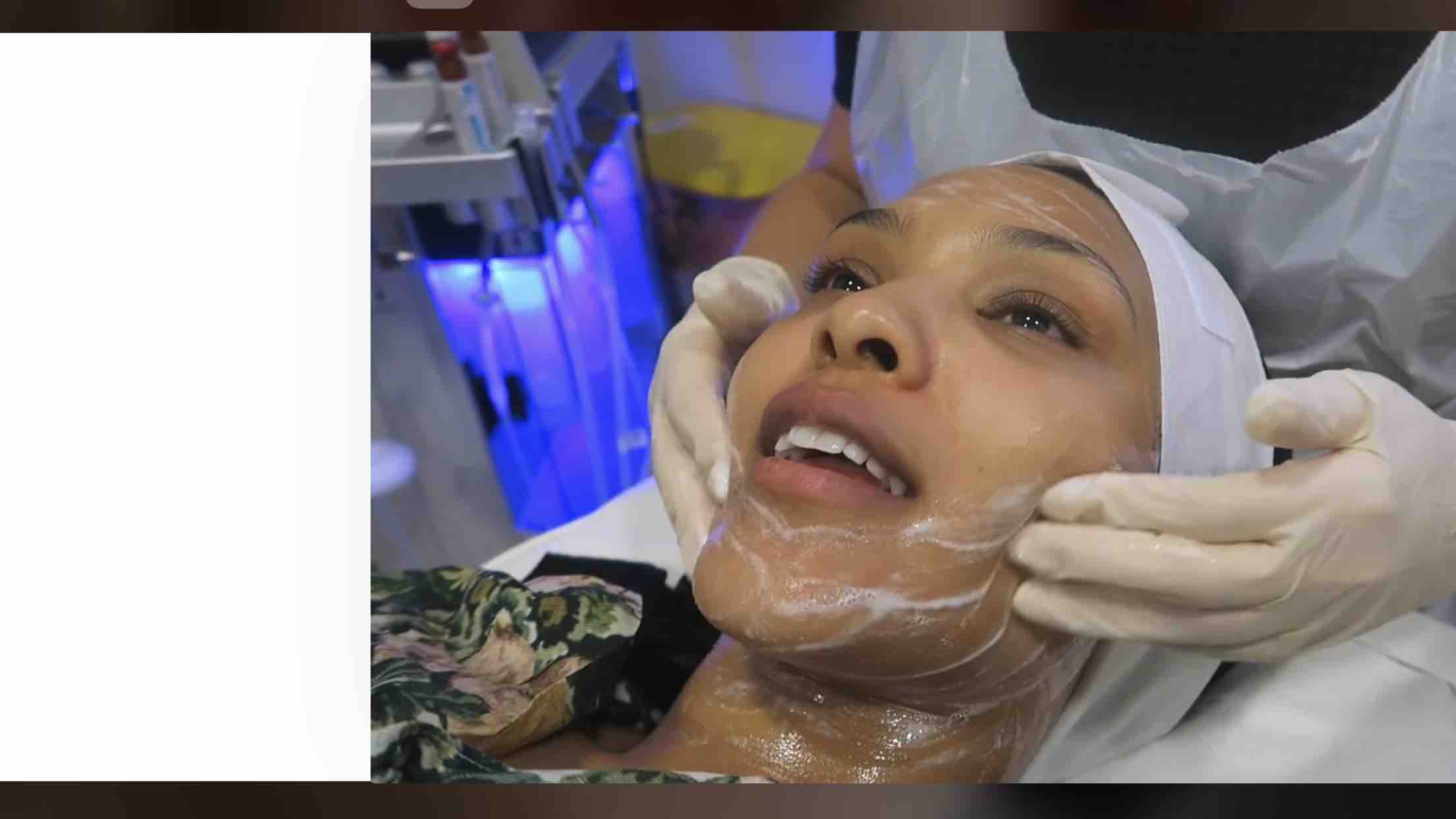 Glycolic Peel Facial