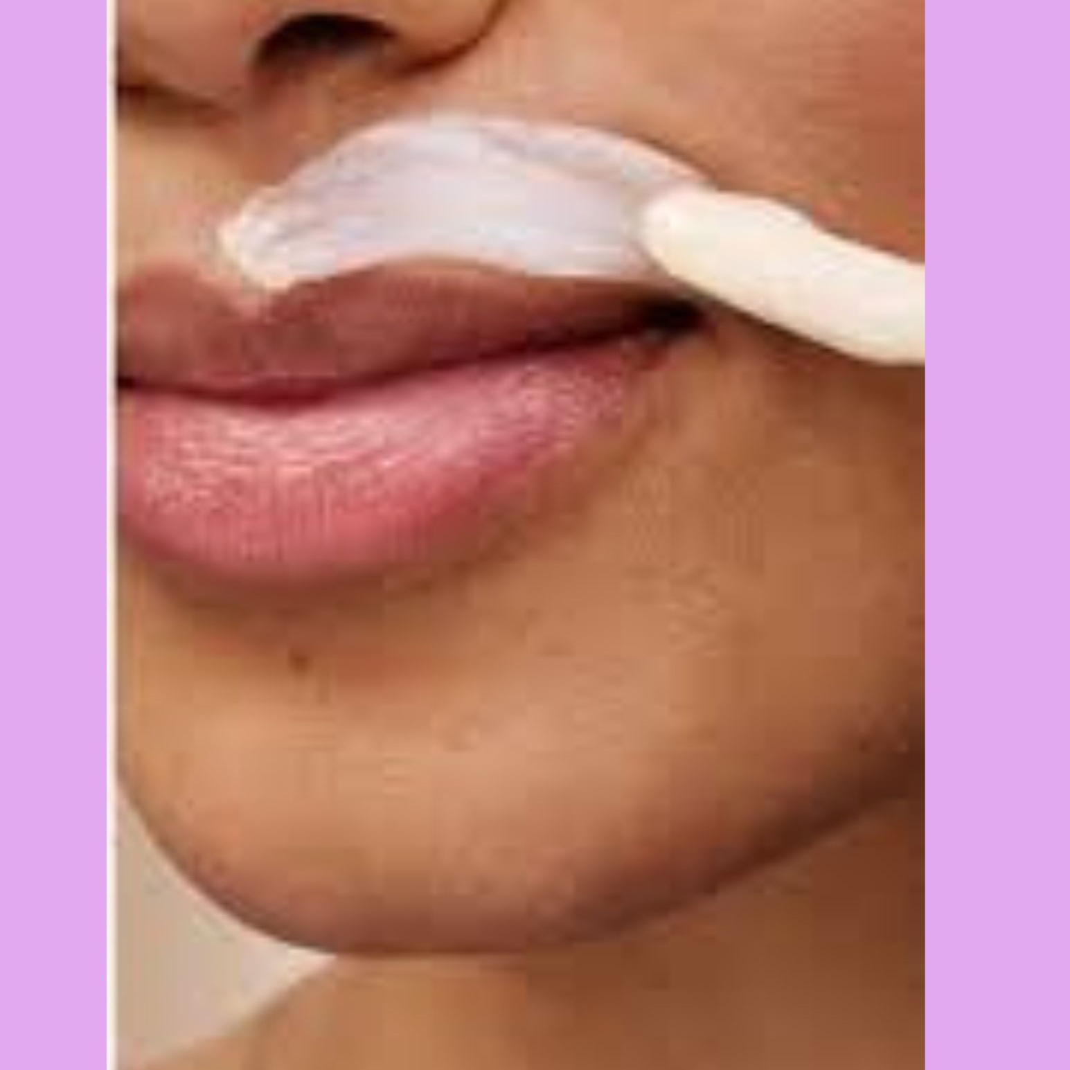 Lip or chin hair removal