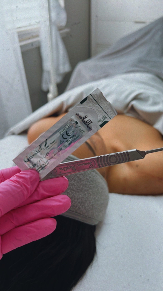 Dermaplaning