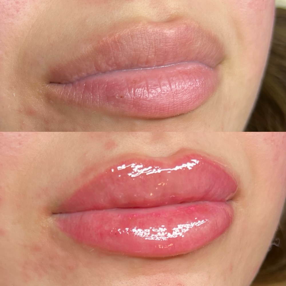 Lip Blushing 💋