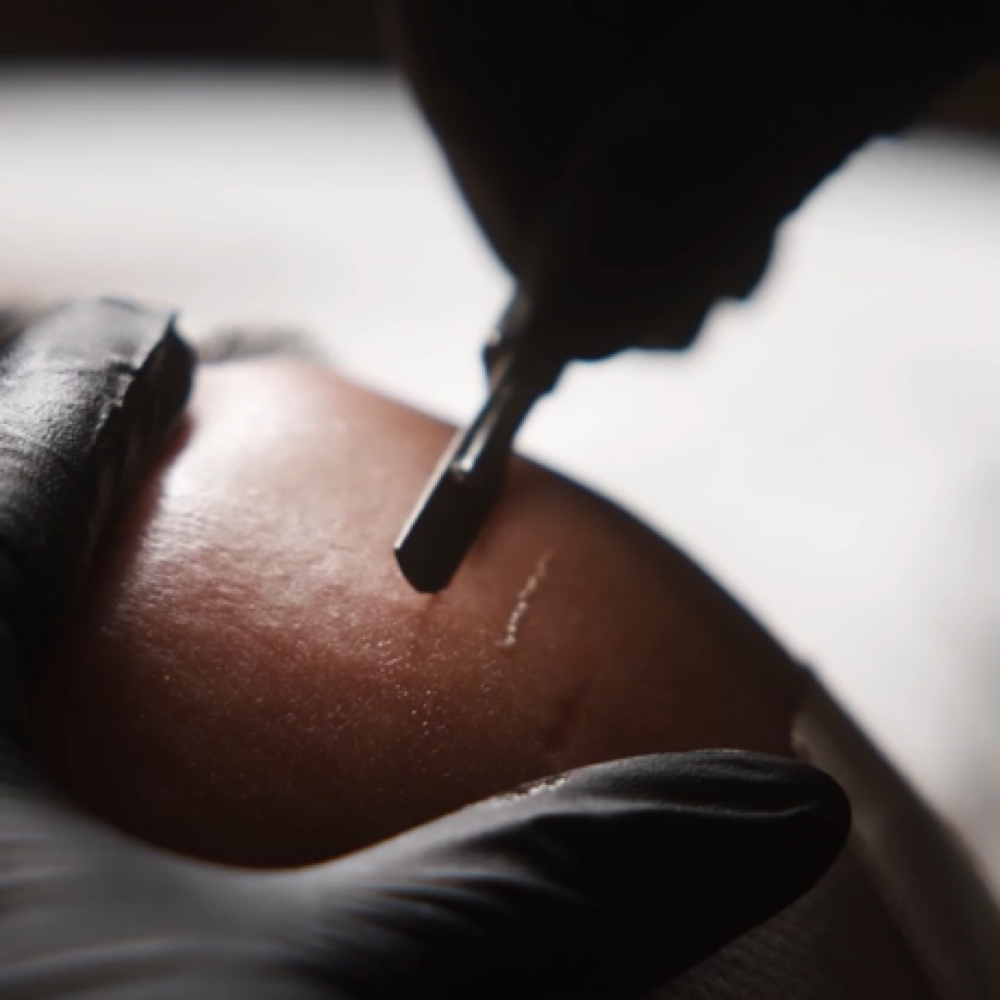 Dermaplaning at Luxe Aesthetics Studio in Peoria, IL