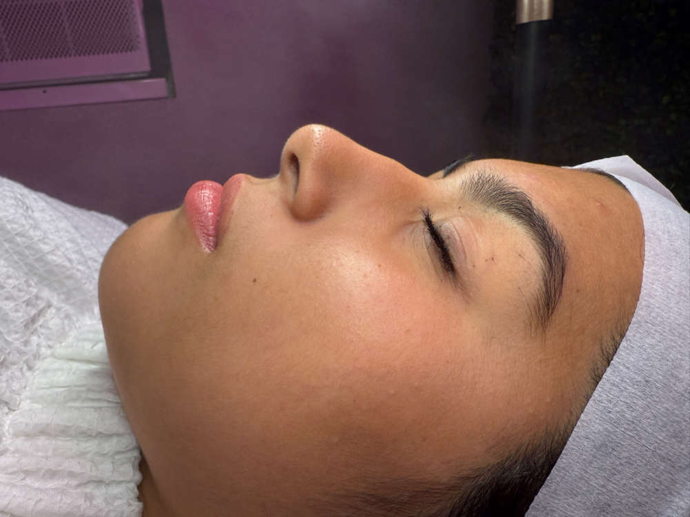 Teen Facial