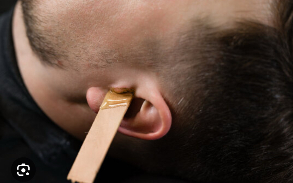 Ear Wax