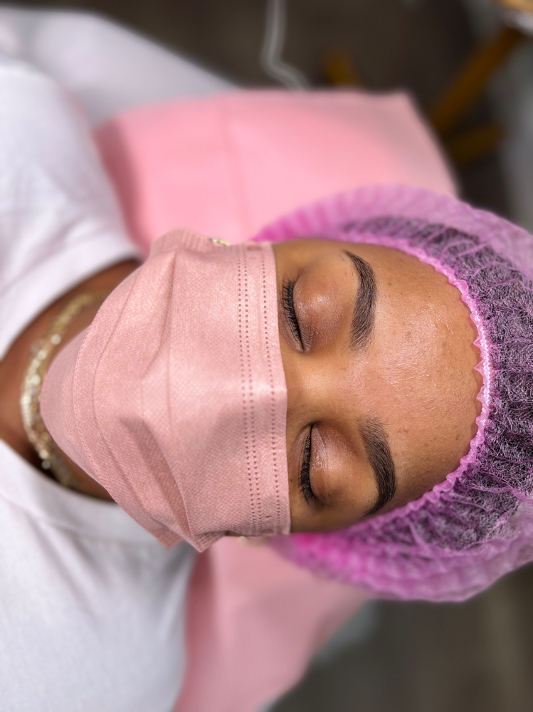 4-8 WEEK BROW TOUCH-UP PROCEDURE.
