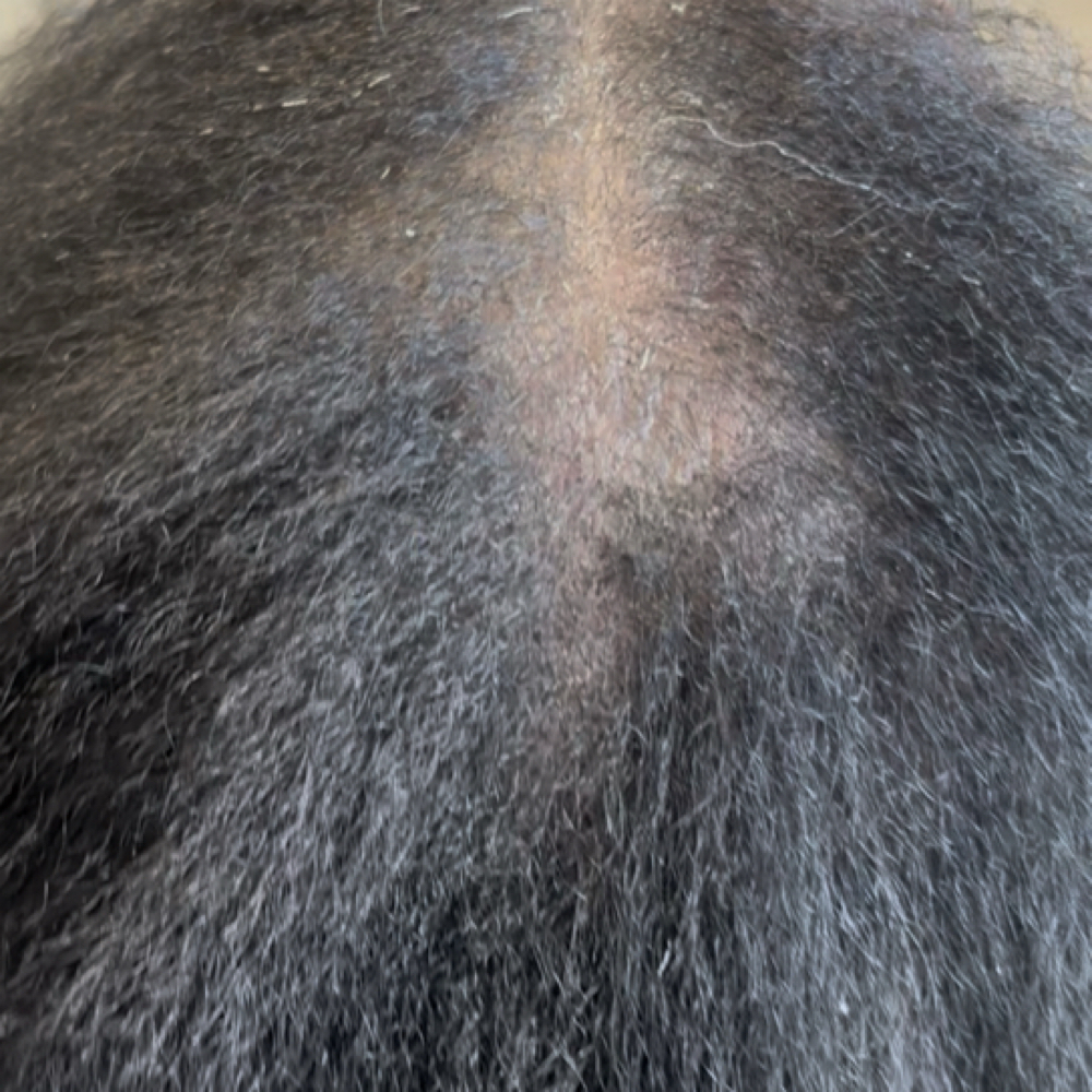 Hair scalp analysis at Crownz Heavenly Palace in Maryland, MD