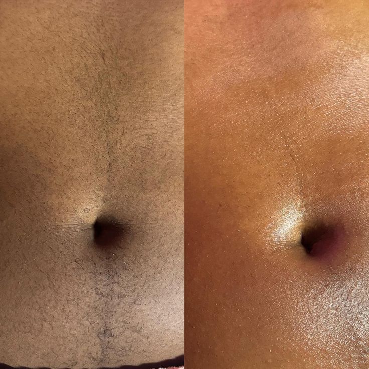 Stomach Wax
