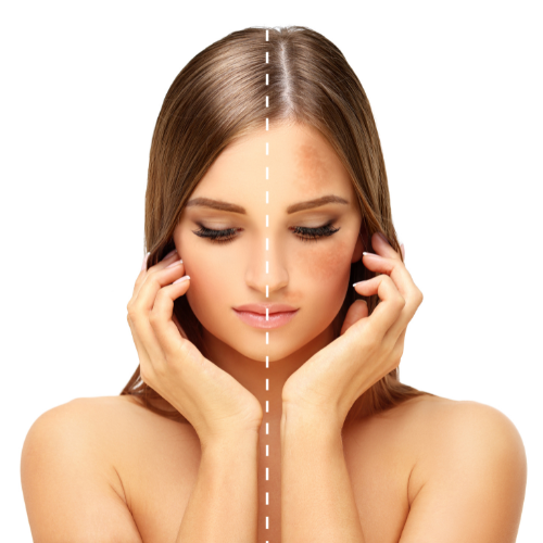 ADVANCED DARKSPOT CORRECTION 10PACK at Star Spa Lash & Brow By: Evelyn Esthetician in Oakland, NJ