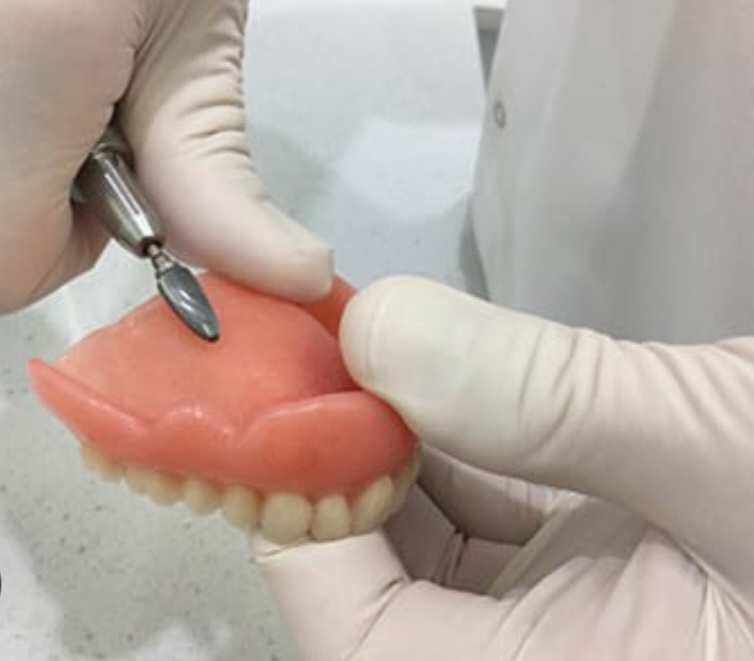 Denture Adjustment