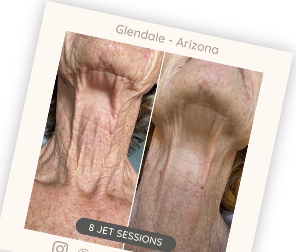 Pro Plasma Series Of 8