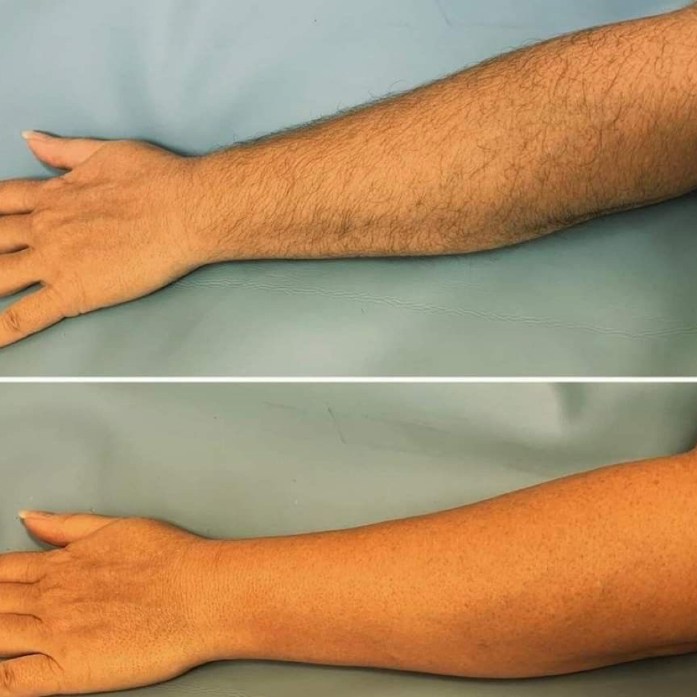 Half Arms Waxing at Natis Nail Spa in San Marcos, TX