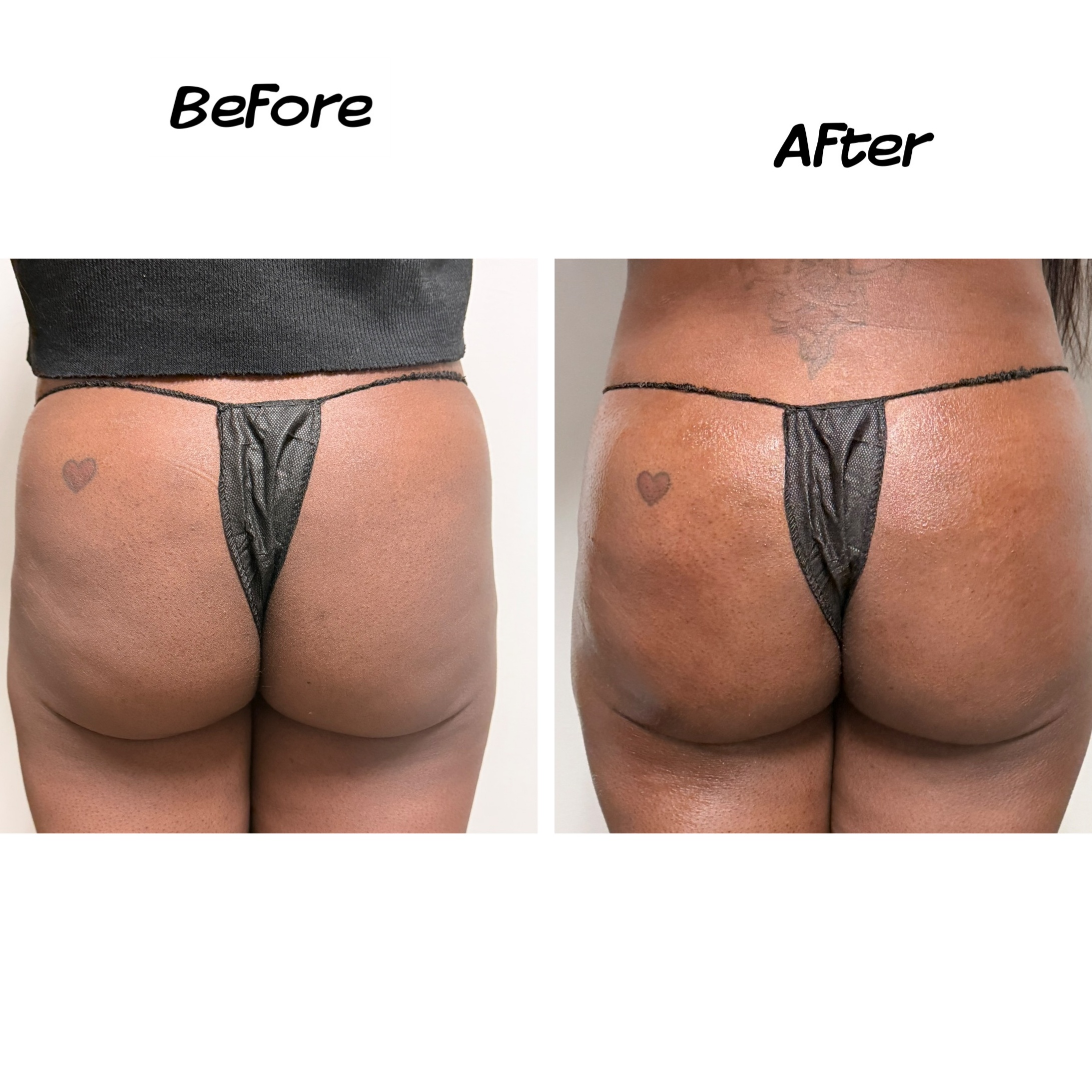 Black Friday Liquid BBL Gold