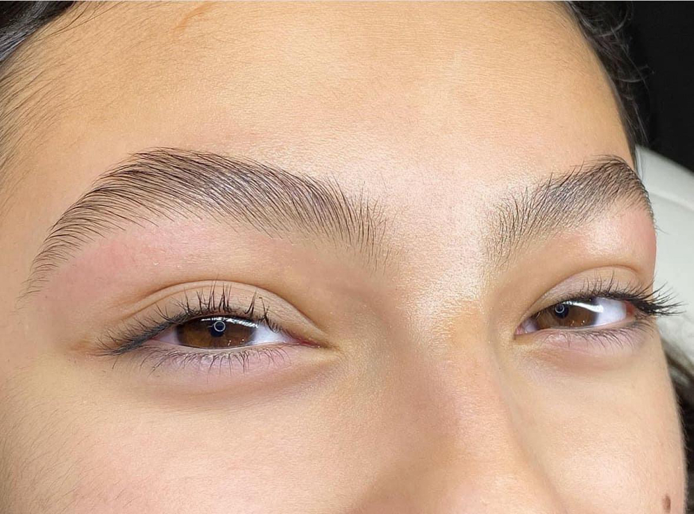 Skin PEEL (must Book Facial 1st)