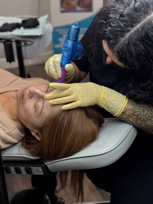 Procell Face Rejuvenation