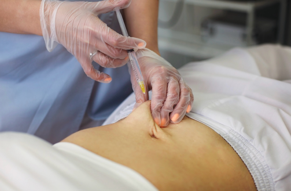 PCDC Lipo injections