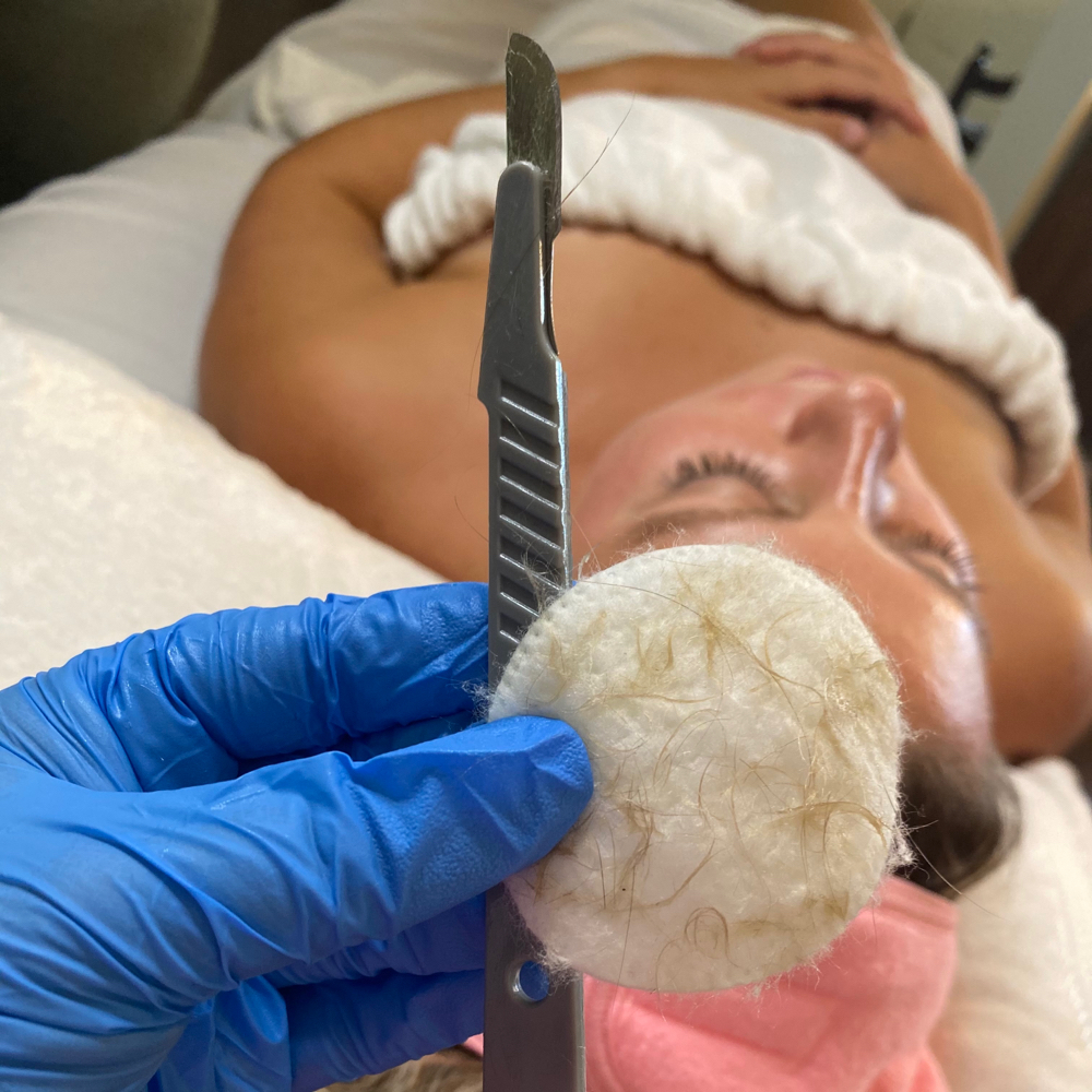 Add On Dermaplane