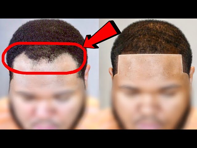 Hairline(Just A line)