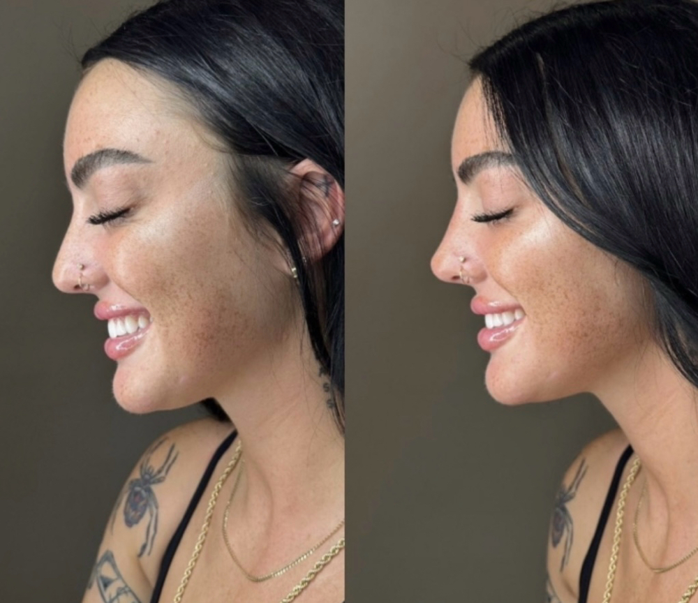 Pixie Nose Contouring