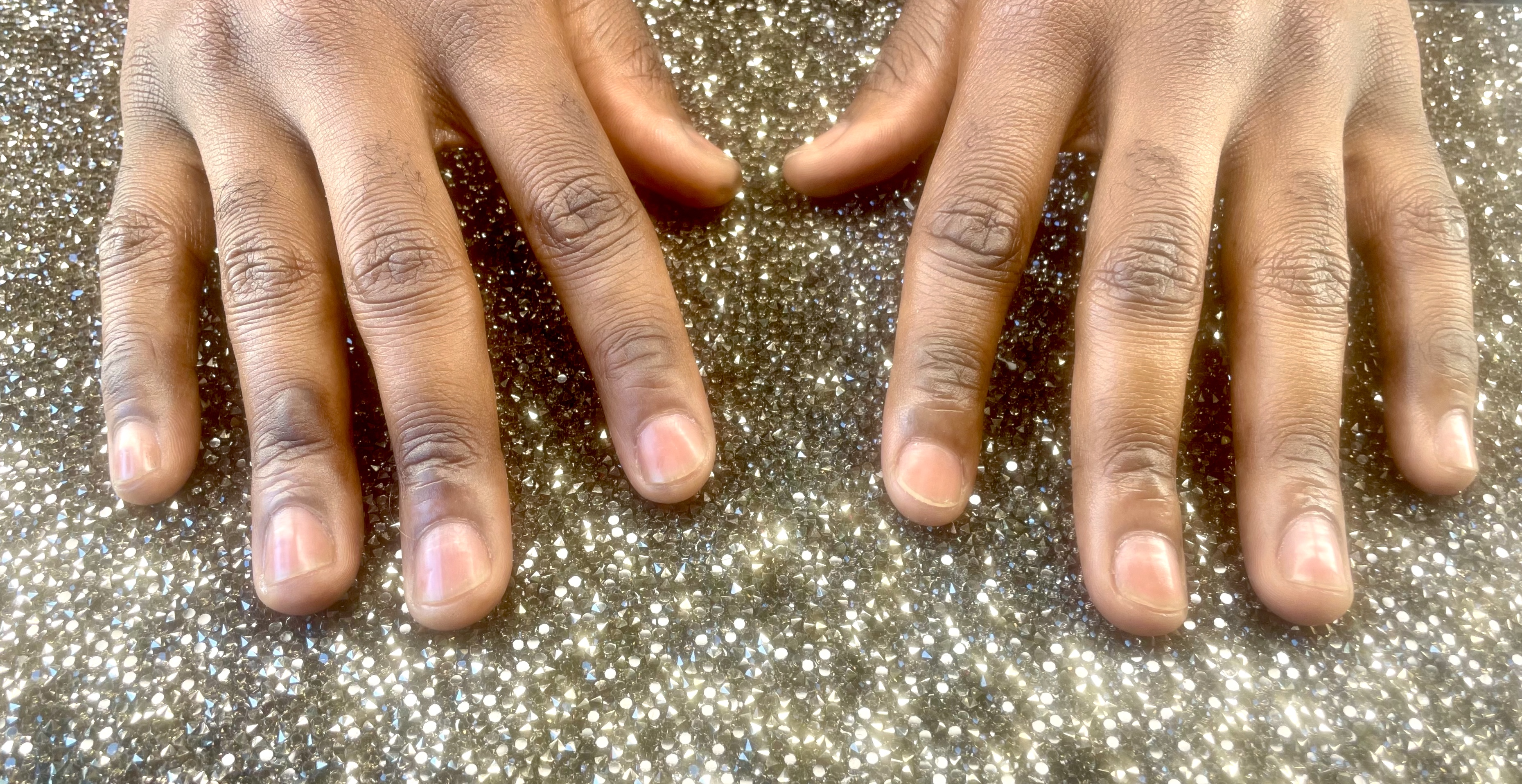 'MAN'icure