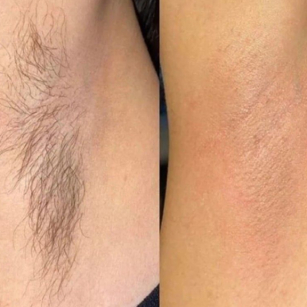 Underarm Wax at Esthetics By Emma in Church Hill, TN