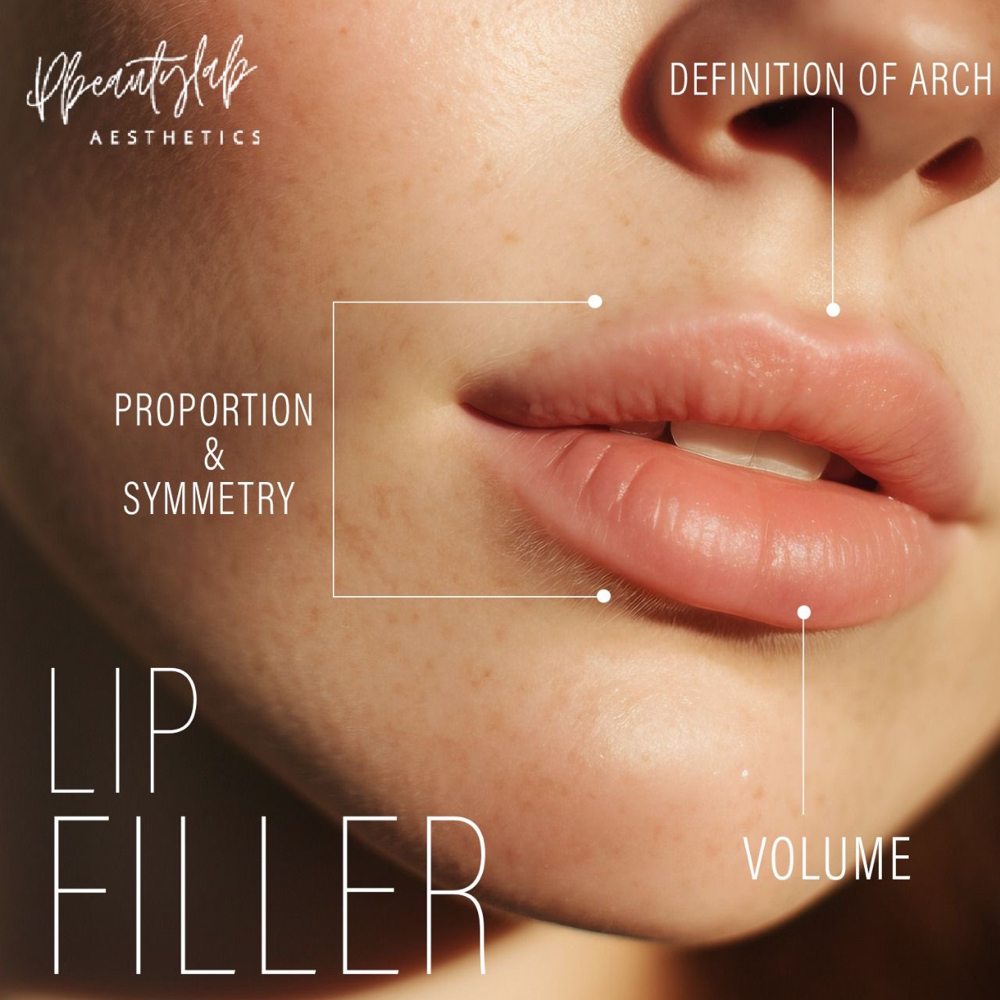 LIP FILLERS
