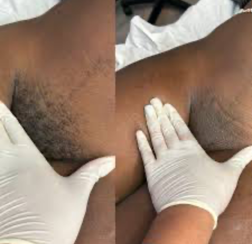 BRAZILIAN WAX at Royal Glow Experience LLC in Houston, TX