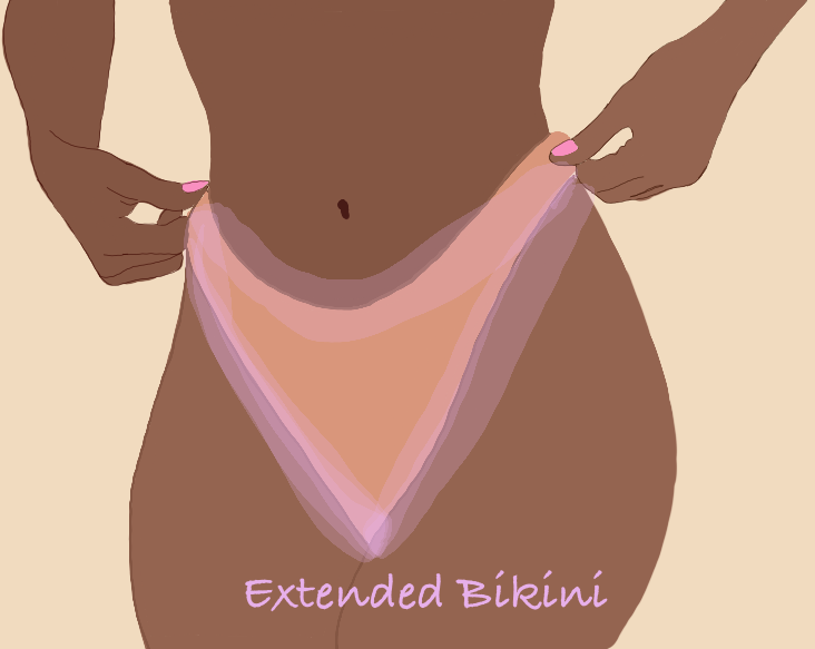 Extended Bikini (Female Anatomy)