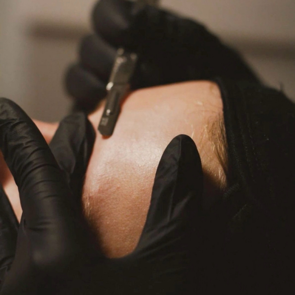 Dermaplane Facial at luxurybyliv in Aberdeen, SD