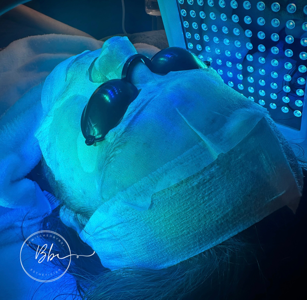 LED Light Therapy + Customized Mask