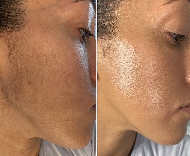 Dermaplane Facial