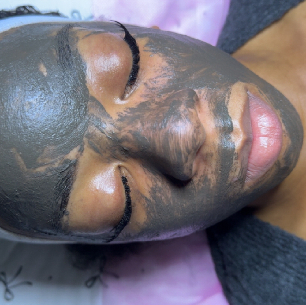 Acne Maintenance Treatment at Bodied By Takis in Ridgeland, MS