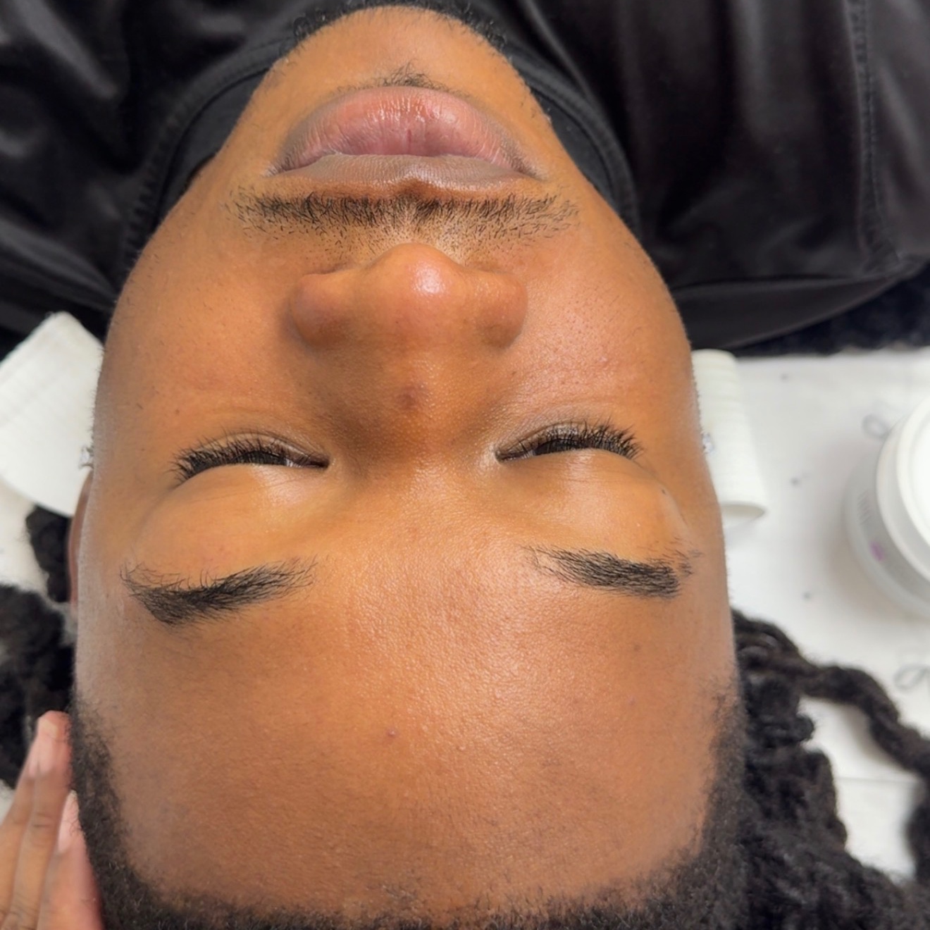 Acne Maintenance Treatment at Bodied By Takis in Ridgeland, MS