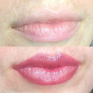 Permanent Lip Tattooing