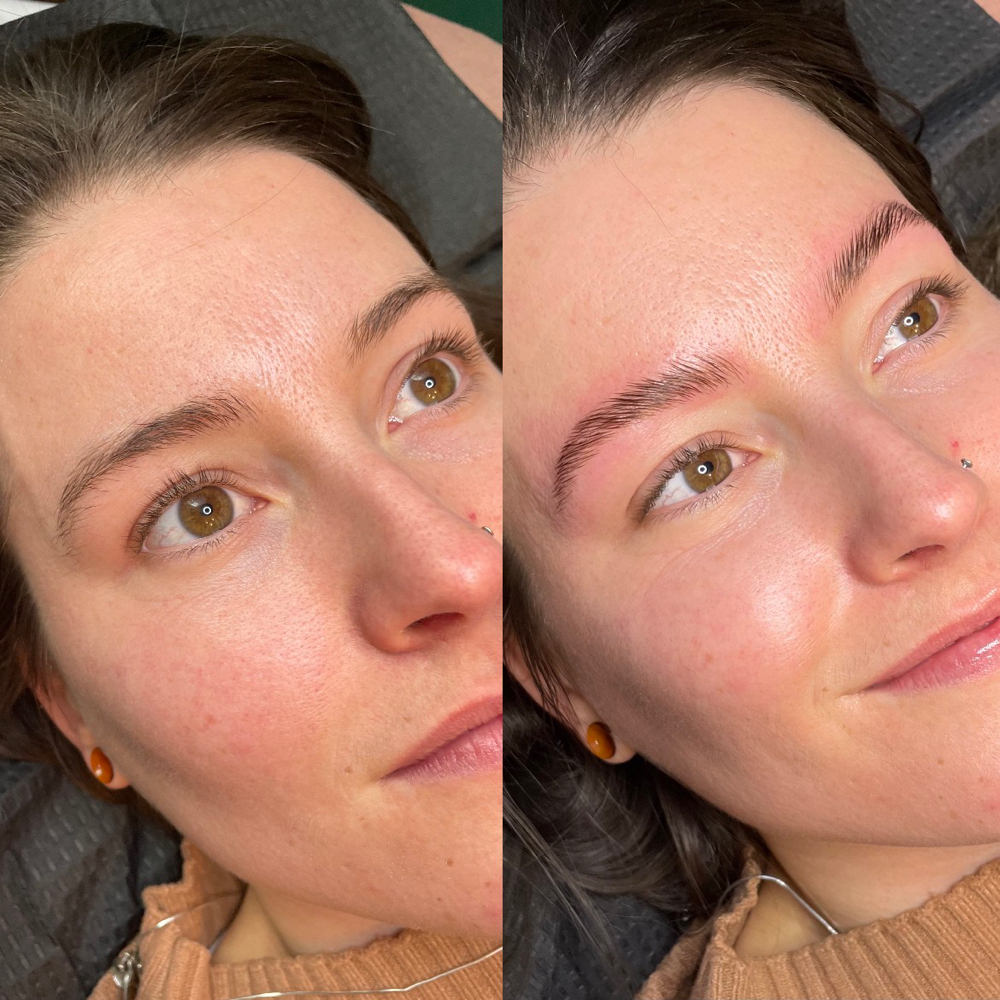 Brow Lamination