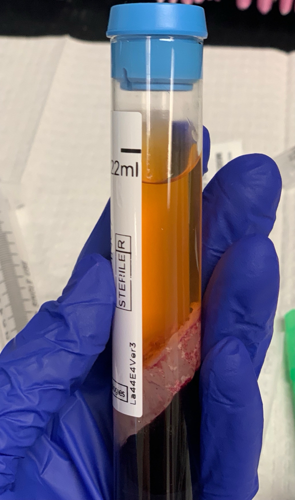 PRP ADD ON at Skin Aesthetics Studio in East Bernard, TX