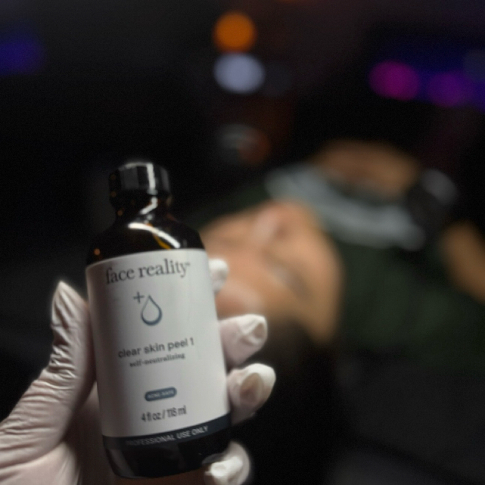 Clear Skin Peels 3 PK