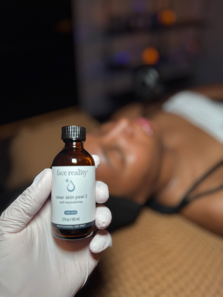 Clear Skin Peels 3 PK