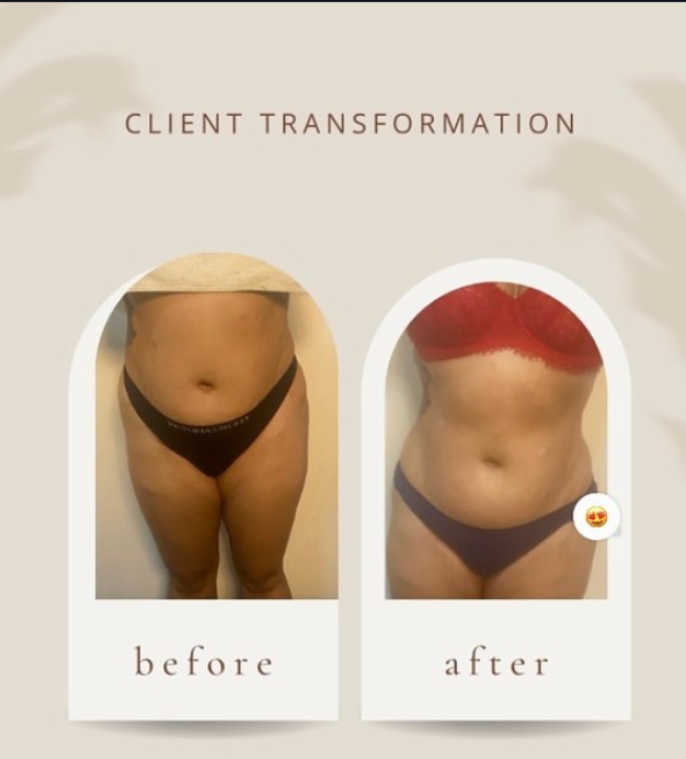 One area only(Stomach/Legs/or Butt)