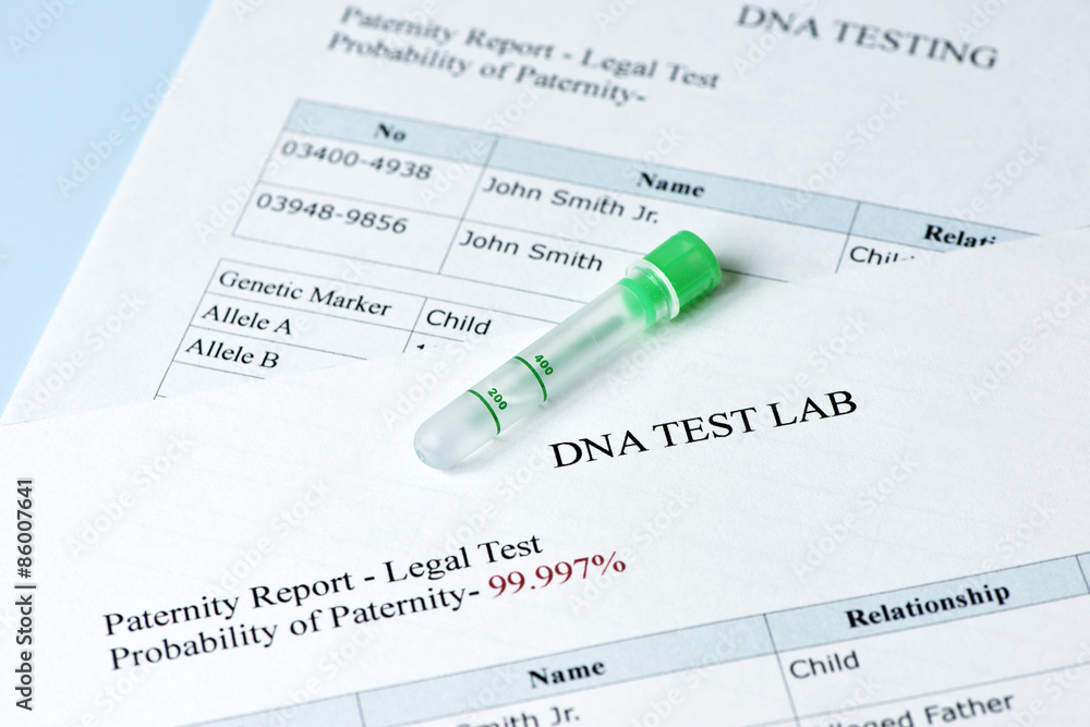 NIPP PATERNITY TEST