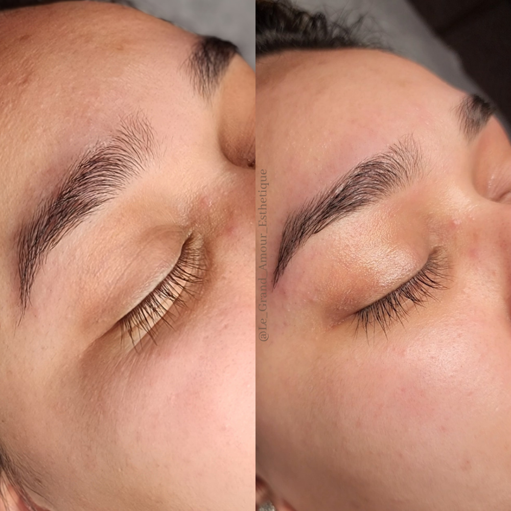 Brow Shaping