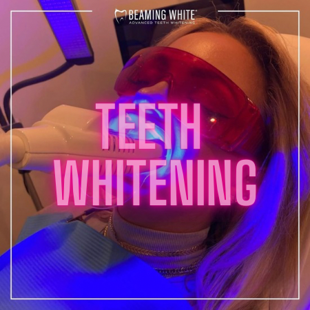 Teeth Whitening