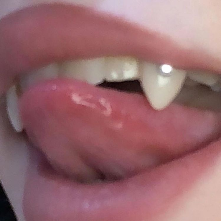 TOOTH GEM FLASH