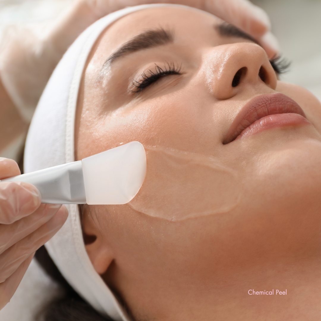 Dermaplaning + Chemical Peel