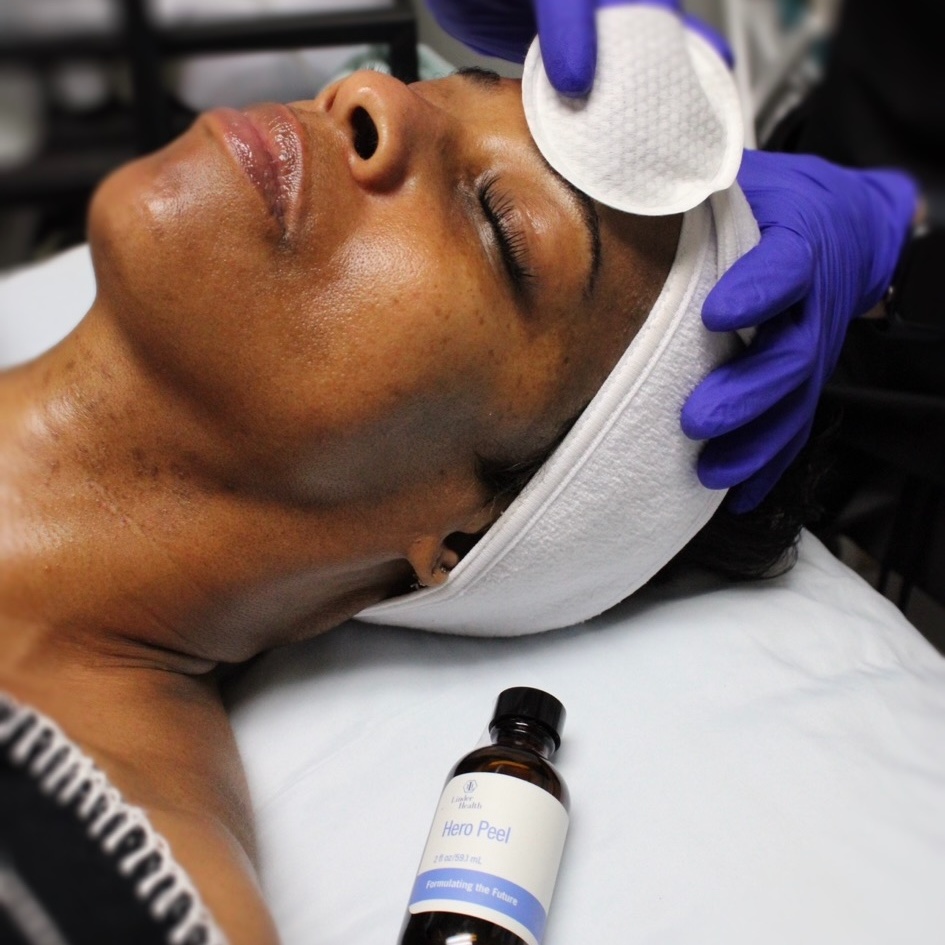 Linder Clarify,Brighten, Renew Peel at Affinity & Glow Aesthetics in Royal Oak, MI
